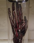 Dissected Hand